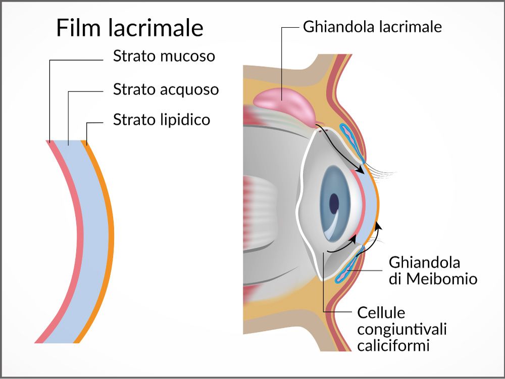 Sindrome dell'occhio secco